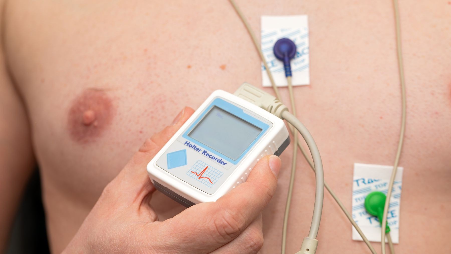 Holter Image