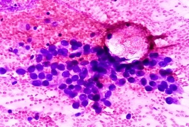 Cytology Image
