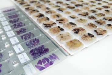 Histopathology Image